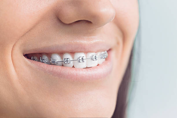 Best Dental Bonding  in Weatherford, OK
